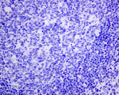 Immunohistochemistry (Formalin/PFA-fixed paraffin-embedded sections) - Anti-AP-A antibody [EPR9411(2)] (ab155991), expandable thumbnail