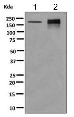 Western blot - Anti-AP-A antibody [EPR9411(2)] (AB155991), expandable thumbnail