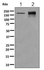 Western blot - Anti-AP-A antibody [EPR9411(2)] (AB155991)