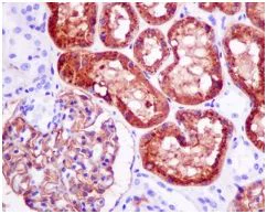 Immunohistochemistry (Formalin/PFA-fixed paraffin-embedded sections) - Anti-AP-A antibody [EPR9411(2)] - BSA and Azide free (AB249235)