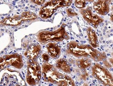 Immunohistochemistry (Formalin/PFA-fixed paraffin-embedded sections) - Anti-AP-A antibody [SR1222] (AB326687)