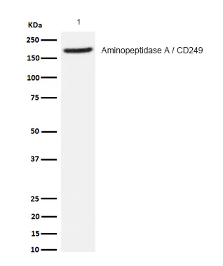 Western blot - Anti-AP-A antibody [SR1222] (AB326687)
