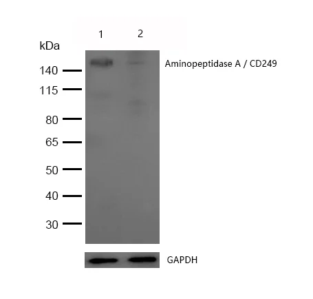 Western blot - Anti-AP-A antibody [SR1222] (AB326687)