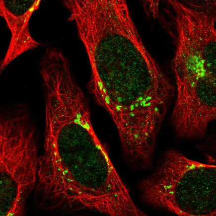 Immunocytochemistry/ Immunofluorescence - Anti-AP-B antibody (AB220088)