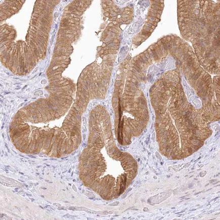 Immunohistochemistry (Formalin/PFA-fixed paraffin-embedded sections) - Anti-AP-B antibody (AB220088)