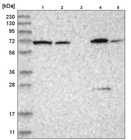 Western blot - Anti-AP-B antibody (AB220088)