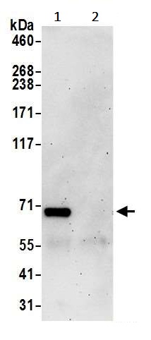 Immunoprecipitation - Anti-AP-B antibody (AB241289)
