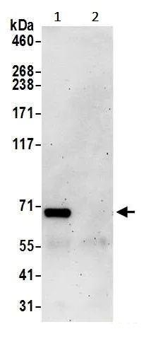 Immunoprecipitation - Anti-AP-B antibody (AB241289)