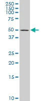 Western blot - Anti-AP1M1 antibody (AB194384)