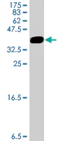 Western blot - Anti-AP1M1 antibody (AB194384)