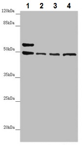 Western blot - Anti-AP1M1 antibody (AB230273)