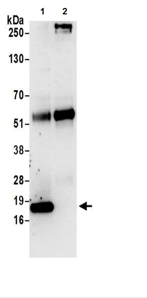 Immunoprecipitation - Anti-AP1S1 antibody (AB217055)