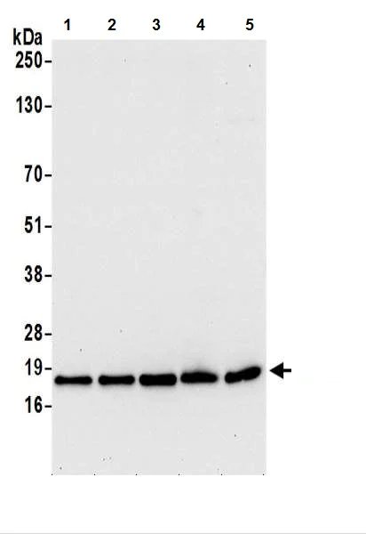 Western blot - Anti-AP1S1 antibody (AB217055)
