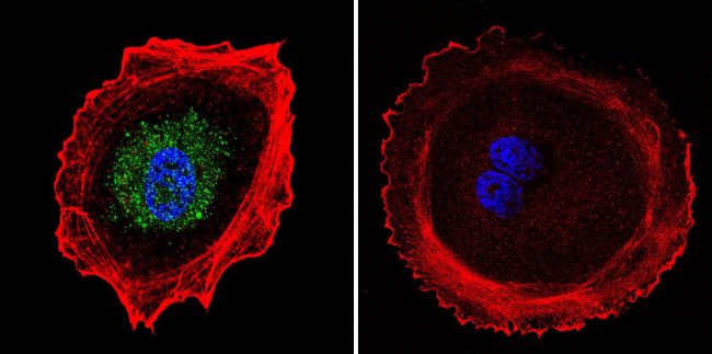 Immunocytochemistry/ Immunofluorescence - Anti-AP2 gamma/TFAP2C antibody [3B5] (AB110635), expandable thumbnail