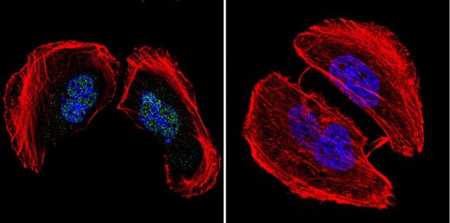 Immunocytochemistry/ Immunofluorescence - Anti-AP2 gamma/TFAP2C antibody [3B5] (AB110635), expandable thumbnail
