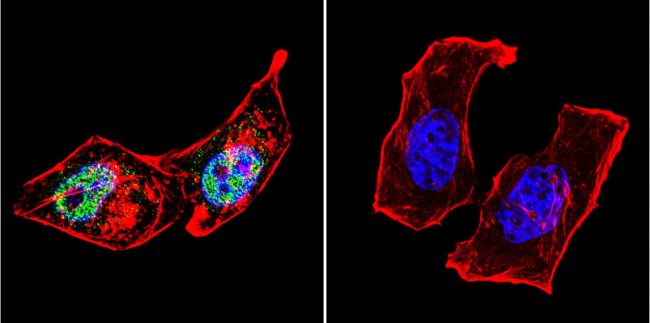 Immunocytochemistry/ Immunofluorescence - Anti-AP2 gamma/TFAP2C antibody [3B5] (AB110635), expandable thumbnail
