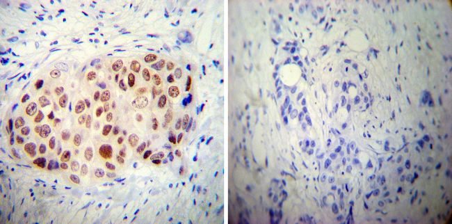 Immunohistochemistry (Formalin/PFA-fixed paraffin-embedded sections) - Anti-AP2 gamma/TFAP2C antibody [3B5] (AB110635), expandable thumbnail