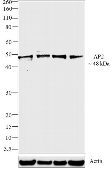 Western blot - Anti-AP2 gamma/TFAP2C antibody [3B5] (AB110635), expandable thumbnail