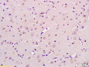 Immunohistochemistry (Formalin/PFA-fixed paraffin-embedded sections) - Anti-AP2 gamma/TFAP2C antibody (AB203691)