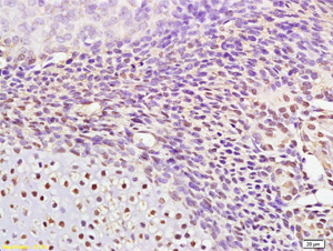 Immunohistochemistry (Formalin/PFA-fixed paraffin-embedded sections) - Anti-AP2 gamma/TFAP2C antibody (AB203691), expandable thumbnail