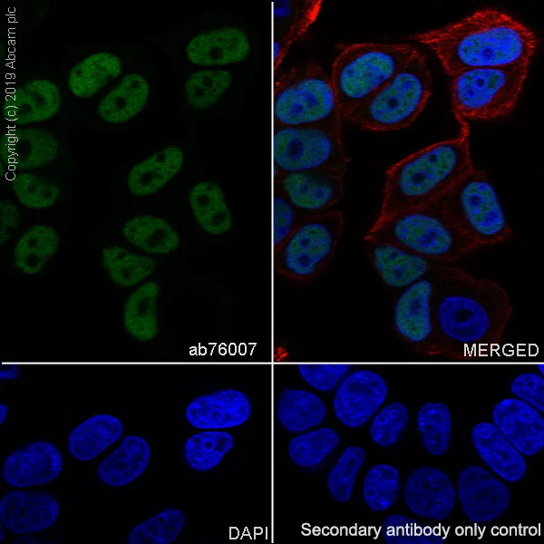 Immunocytochemistry/ Immunofluorescence - Anti-AP2 gamma/TFAP2C antibody [EP2692Y] (AB76007)