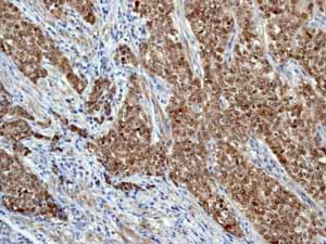 Immunohistochemistry (Formalin/PFA-fixed paraffin-embedded sections) - Anti-AP2 gamma/TFAP2C antibody [EP2692Y] (AB76007)