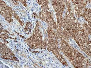 Immunohistochemistry (Formalin/PFA-fixed paraffin-embedded sections) - Anti-AP2 gamma/TFAP2C antibody [EP2692Y] (AB76007)