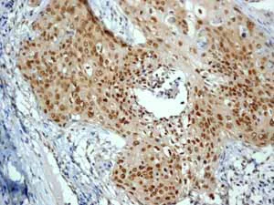 Immunohistochemistry (Formalin/PFA-fixed paraffin-embedded sections) - Anti-AP2 gamma/TFAP2C antibody [EP2692Y] (AB76007)