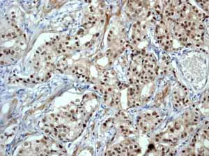 Immunohistochemistry (Formalin/PFA-fixed paraffin-embedded sections) - Anti-AP2 gamma/TFAP2C antibody [EP2692Y] (AB76007)