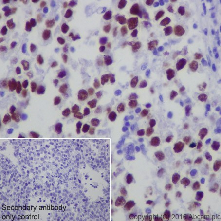 Anti-AP2 gamma/TFAP2C antibody [EPR20331] (ab218107) | Abcam