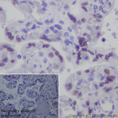 Anti-AP2 gamma/TFAP2C antibody [EPR20331] (ab218107) | Abcam
