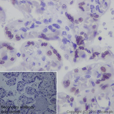 Immunohistochemistry (Formalin/PFA-fixed paraffin-embedded sections) - Anti-AP2 gamma/TFAP2C antibody [EPR20331] (AB218107)