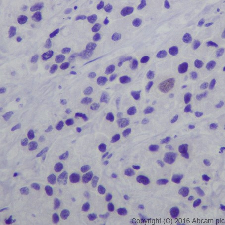 Anti-AP2 gamma/TFAP2C antibody [EPR20331] (ab218107) | Abcam