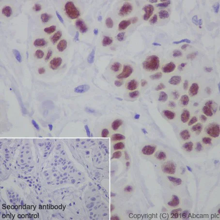 Immunohistochemistry (Formalin/PFA-fixed paraffin-embedded sections) - Anti-AP2 gamma/TFAP2C antibody [EPR20331] - BSA and Azide free (AB251558)