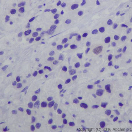 Immunohistochemistry (Formalin/PFA-fixed paraffin-embedded sections) - Anti-AP2 gamma/TFAP2C antibody [EPR20331] - BSA and Azide free (AB251558)
