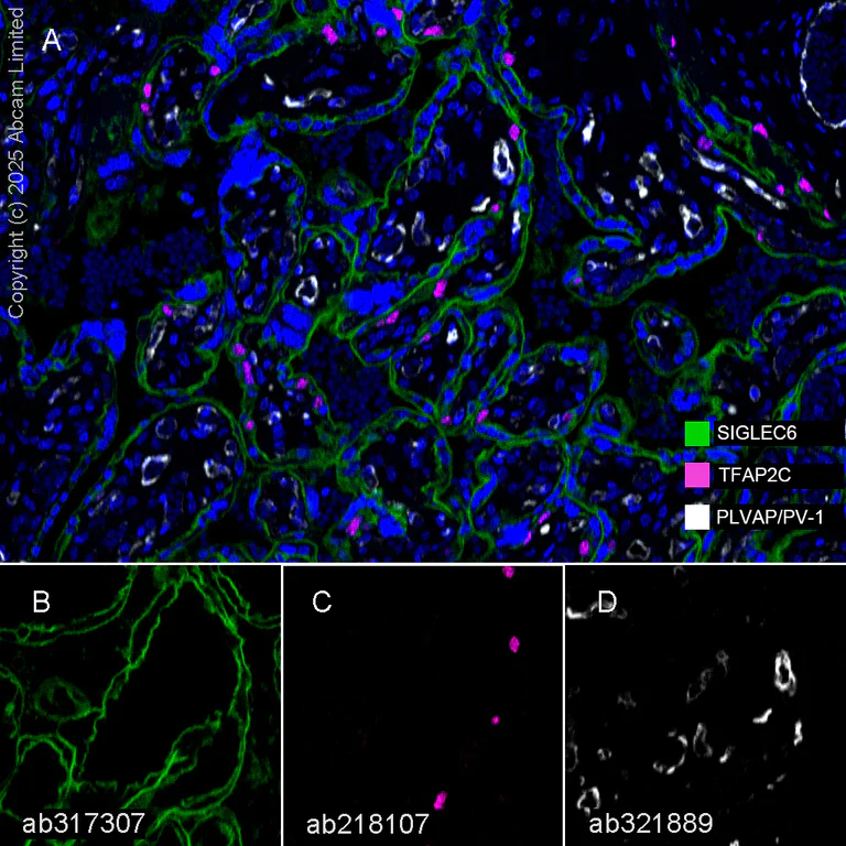 Multiplex immunohistochemistry - Anti-AP2 gamma/TFAP2C antibody [EPR20331] - BSA and Azide free (AB251558)