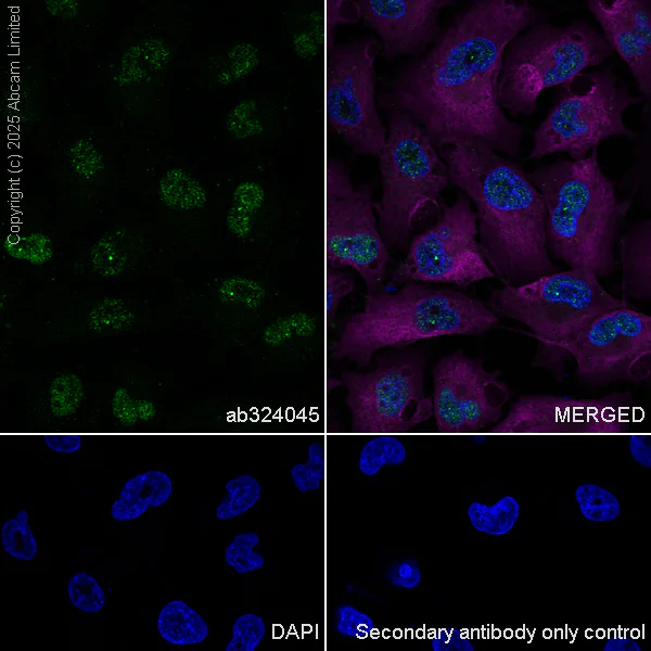 Immunocytochemistry/ Immunofluorescence - Anti-AP2 gamma/TFAP2C antibody [EPR29851-13] (AB324045)
