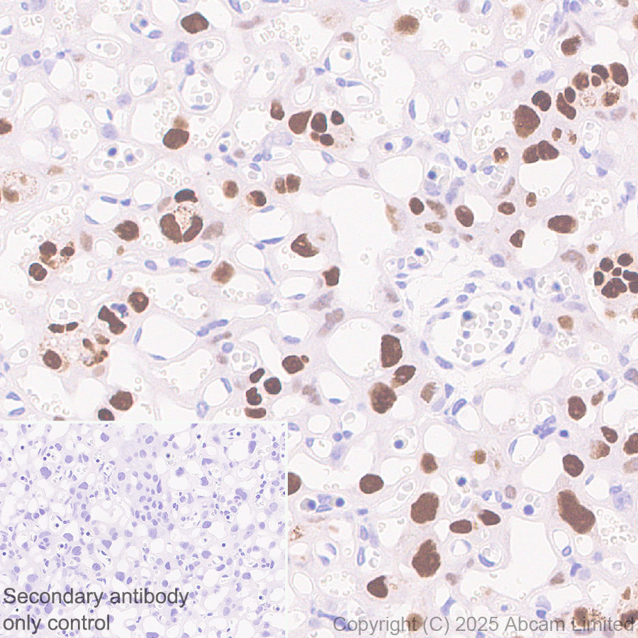 Immunohistochemistry (Formalin/PFA-fixed paraffin-embedded sections) - Anti-AP2 gamma/TFAP2C antibody [EPR29851-13] (AB324045), expandable thumbnail