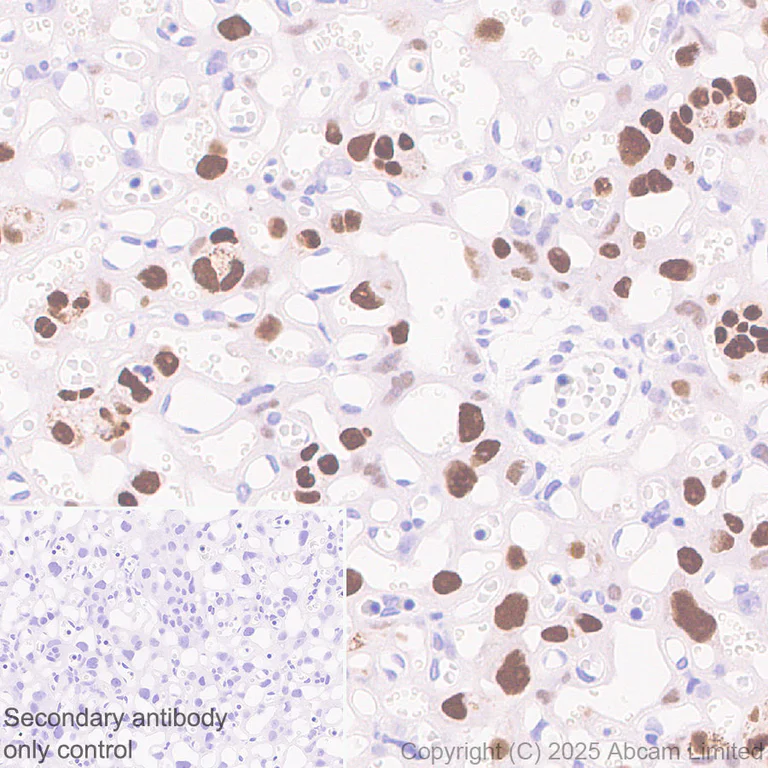 Immunohistochemistry (Formalin/PFA-fixed paraffin-embedded sections) - Anti-AP2 gamma/TFAP2C antibody [EPR29851-13] (AB324045)