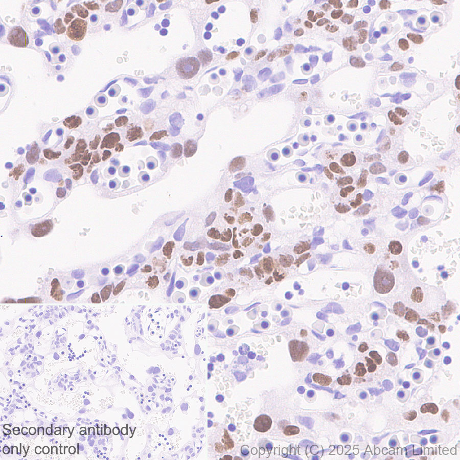 Immunohistochemistry (Formalin/PFA-fixed paraffin-embedded sections) - Anti-AP2 gamma/TFAP2C antibody [EPR29851-13] (ab324045), expandable thumbnail