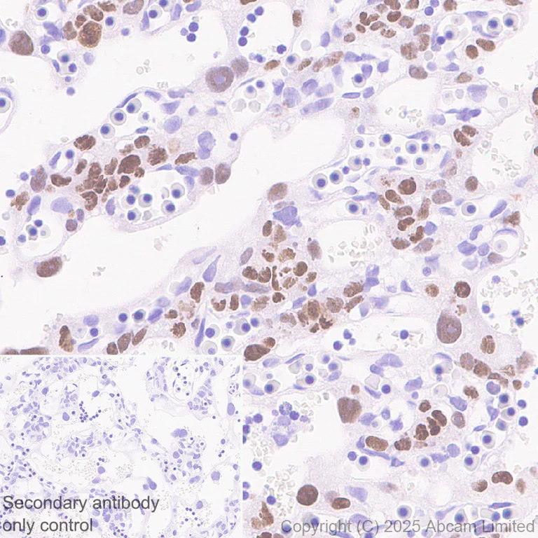 Immunohistochemistry (Formalin/PFA-fixed paraffin-embedded sections) - Anti-AP2 gamma/TFAP2C antibody [EPR29851-13] (AB324045)
