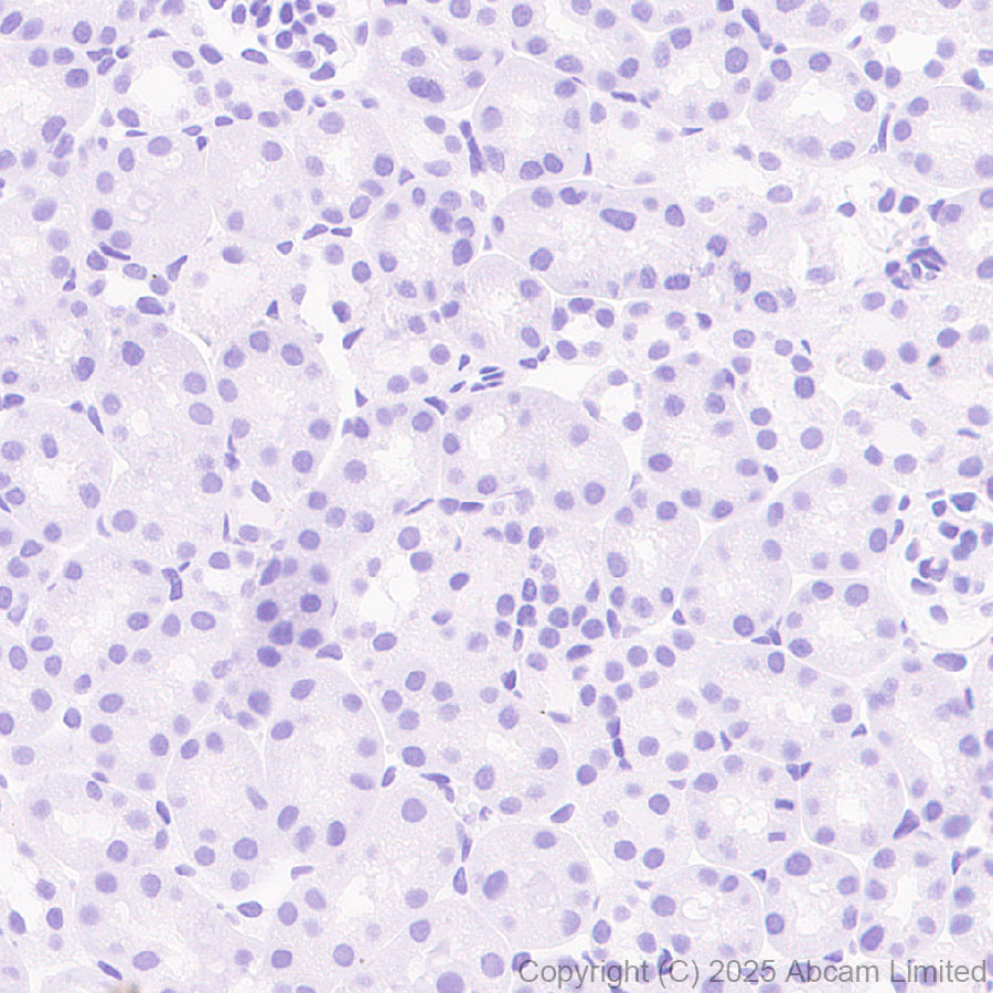 Immunohistochemistry (Formalin/PFA-fixed paraffin-embedded sections) - Anti-AP2 gamma/TFAP2C antibody [EPR29851-13] (ab324045), expandable thumbnail