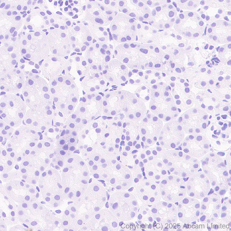 Immunohistochemistry (Formalin/PFA-fixed paraffin-embedded sections) - Anti-AP2 gamma/TFAP2C antibody [EPR29851-13] (AB324045)