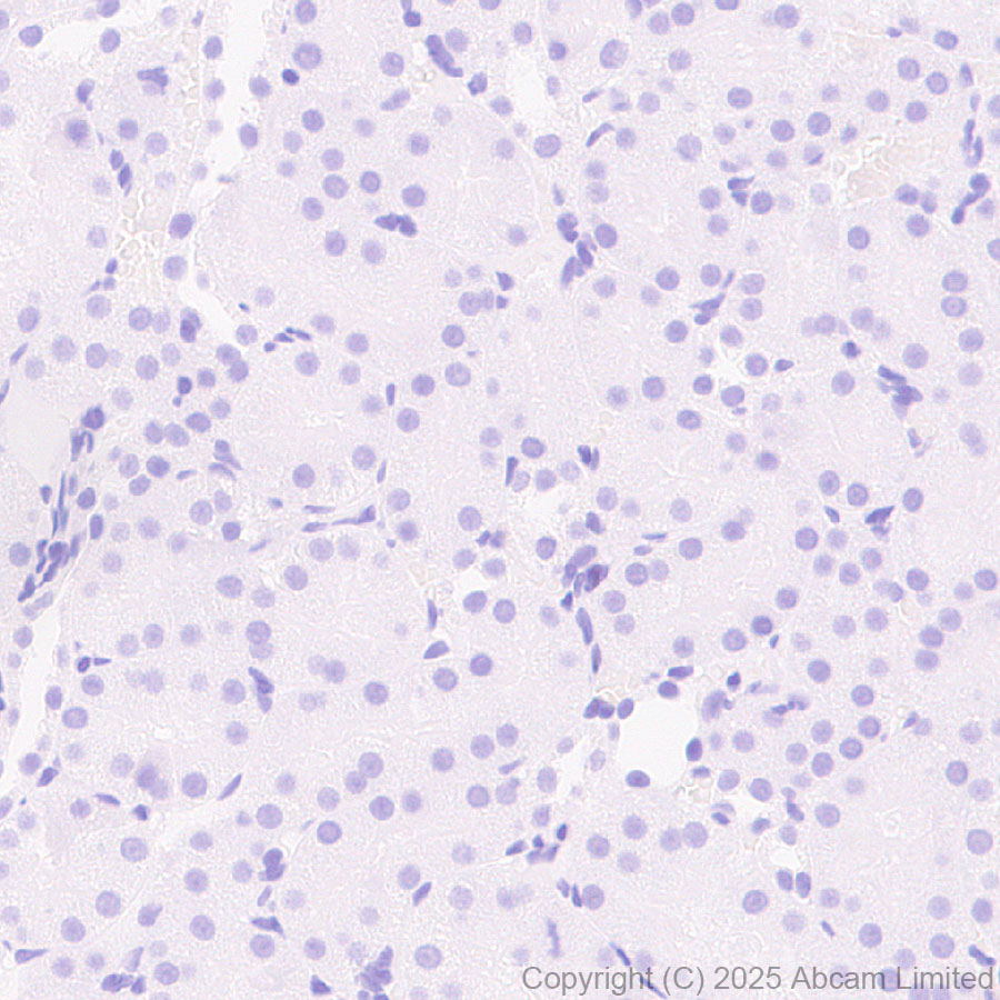 Immunohistochemistry (Formalin/PFA-fixed paraffin-embedded sections) - Anti-AP2 gamma/TFAP2C antibody [EPR29851-13] (ab324045), expandable thumbnail