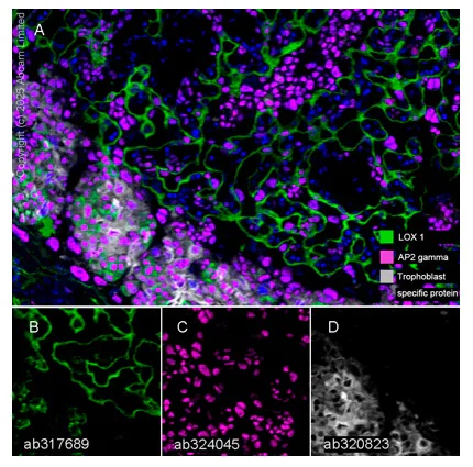 Multiplex immunohistochemistry - Anti-AP2 gamma/TFAP2C antibody [EPR29851-13] (AB324045)