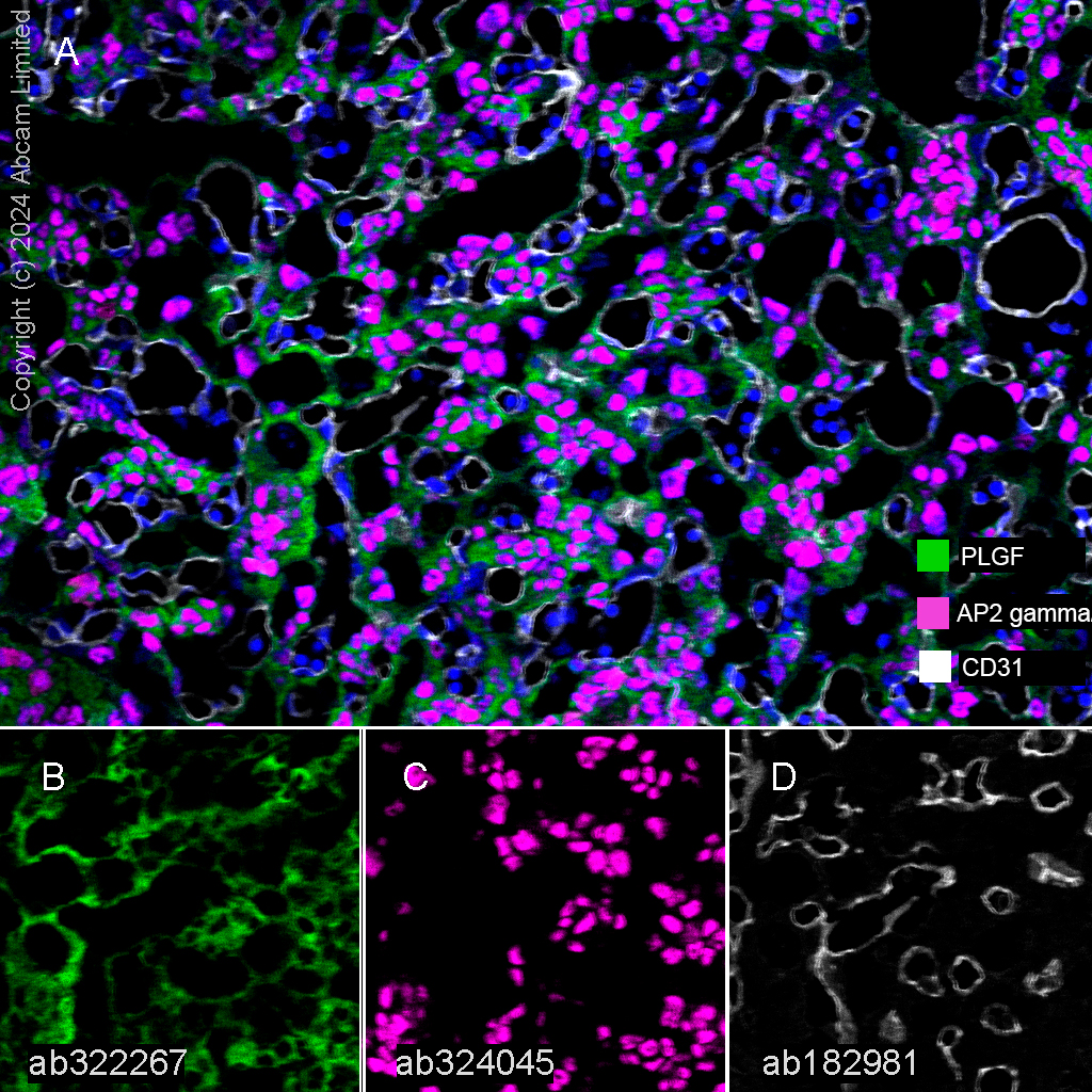 Anti-AP2 gamma/TFAP2C antibody [EPR29851-13] (ab324045) | Abcam
