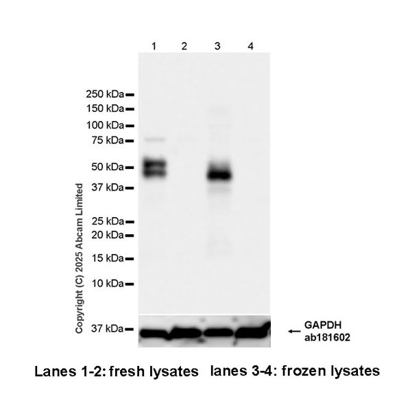 Western blot - Anti-AP2 gamma/TFAP2C antibody [EPR29851-13] (AB324045), expandable thumbnail
