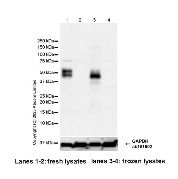 Western blot - Anti-AP2 gamma/TFAP2C antibody [EPR29851-13] (AB324045)