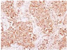 Immunohistochemistry (Formalin/PFA-fixed paraffin-embedded sections) - Anti-AP2B1 antibody (AB151961)
