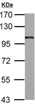 Western blot - Anti-AP2B1 antibody (AB151961)
